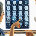 The Revolutionary Role of Medical Imaging in Healthcare