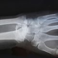 What is the Purpose of Medical Imaging?