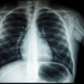 How Medical Imaging is Used to Detect Abnormalities in the Body