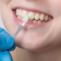 A Closer Look At Dental Health: How Medical Imaging Is Revolutionizing Dentistry In Monroe, LA