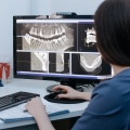 A Closer Look At Dental Health: How Medical Imaging Is Revolutionizing Dentistry In Monroe, LA