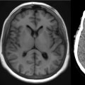 What Can Medical Imaging Detect?
