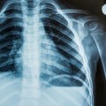 Types of Radiation Used in Medical Imaging Tests