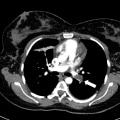 Pregnant Women and Medical Imaging Tests: What You Need to Know