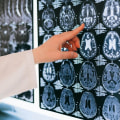 The Cost of a Clear Picture: Why Medical Imaging Can Be So Expensive