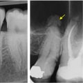 How Medical Imaging Enhances Root Canal Treatments In San Antonio