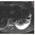 Medical Imaging Tests for Children: Special Considerations