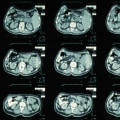 The Connection Between All On 4 Implant Costs And Accurate Medical Imaging In Bexley, NSW