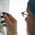 Revolutionary Medical Imaging: How It Has Impacted Diagnosis and Treatment