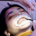 Choosing The Best Orthodontist In San Antonio: A Guide To Finding Expertise In Medical Imaging