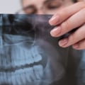 Safety Considerations for Medical Imaging