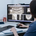 Advanced Medical Imaging In Cedar Park, Texas: Revolutionizing Dental Implants