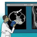 Medical Imaging: A Comprehensive Guide to Detecting Cancer and Other Diseases