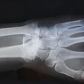Exploring the Different Types of Medical Imaging