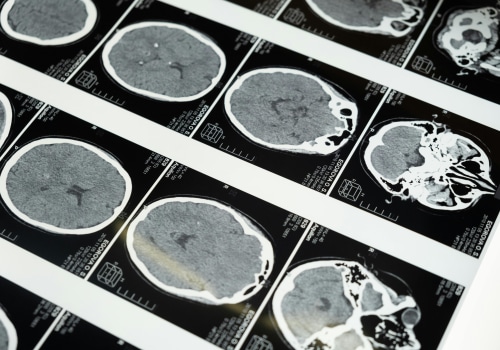 Medical Imaging: How Orange County Rehab Centers Use Technology For Better Care