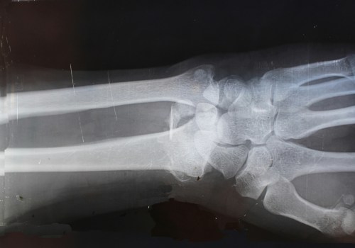 What is the Purpose of Medical Imaging?