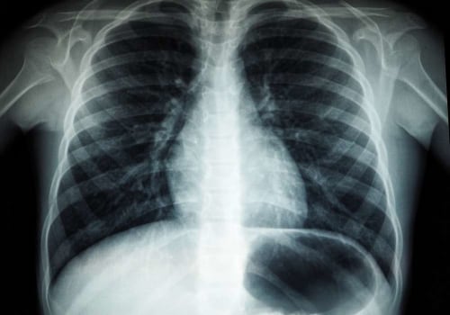 How Medical Imaging is Used to Detect Abnormalities in the Body