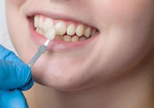 A Closer Look At Dental Health: How Medical Imaging Is Revolutionizing Dentistry In Monroe, LA