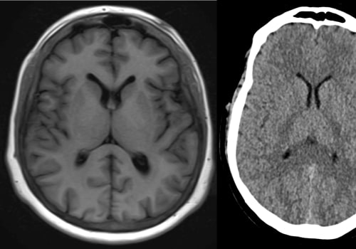 What Can Medical Imaging Detect?