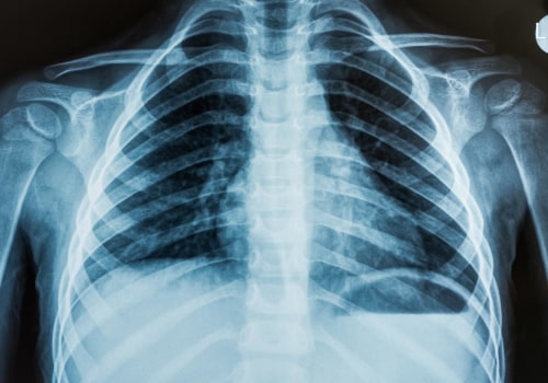Types of Radiation Used in Medical Imaging Tests