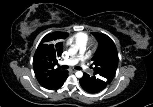 Pregnant Women and Medical Imaging Tests: What You Need to Know