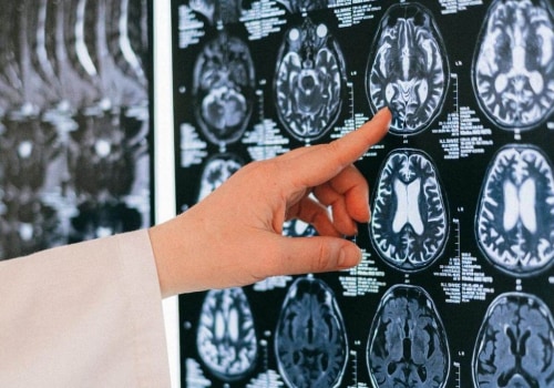 The Cost of a Clear Picture: Why Medical Imaging Can Be So Expensive