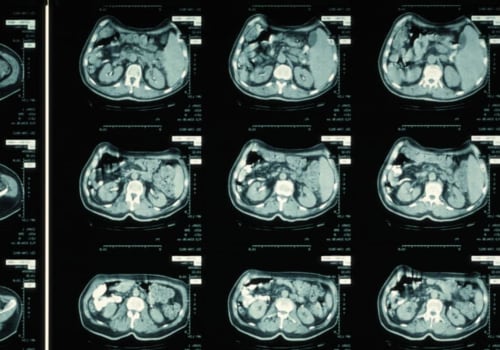 From Diagnosis To Treatment: How Medical Imaging Streamlines Dental Implants In Round Rock, TX