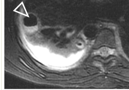 Medical Imaging Tests for Children: Special Considerations