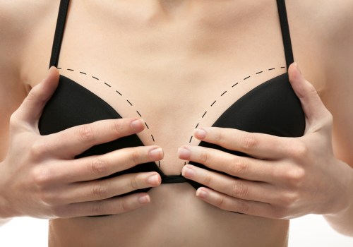 Why Medical Imaging Is Essential For Safe And Successful Breast Augmentation In Danville, CA