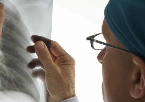 Revolutionary Medical Imaging: How It Has Impacted Diagnosis and Treatment