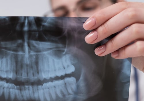 Safety Considerations for Medical Imaging