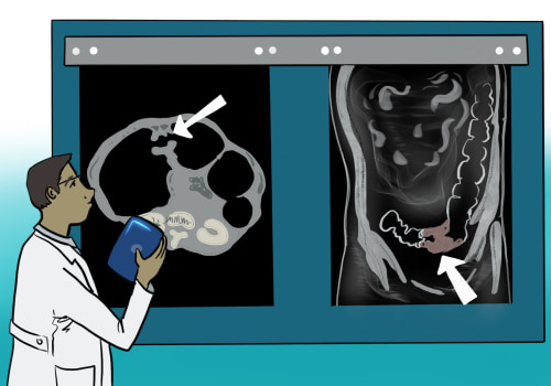 Medical Imaging: A Comprehensive Guide to Detecting Cancer and Other Diseases