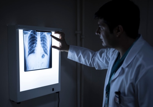 What are the Risks of Medical Imaging?