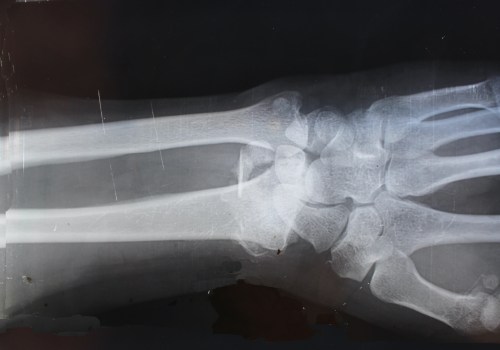 What is the Most Common Form of Medical Imaging?